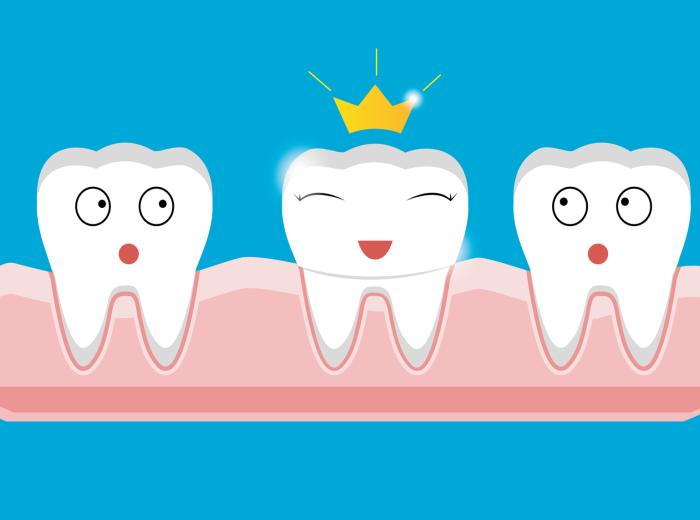Decoding Dental Crowns: Types, Safety, Cost, and Longevity