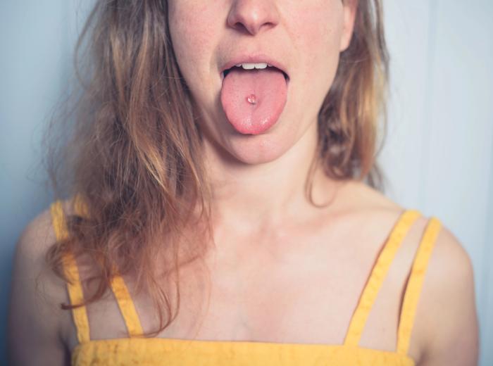 Oral Piercings and Their Effects on Oral Health
