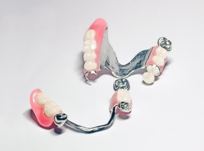 Top 5 Ways Partial Dentures Improve Oral Health