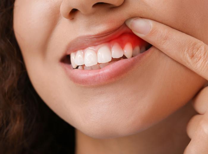 Here’s What Your Dentist in Vegas Wants You to Know About Gum Disease and Diabetes