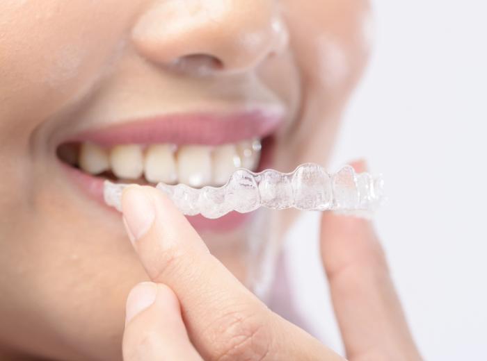 Invisalign® Comfort Tips: How to Handle Soreness and Adjustments