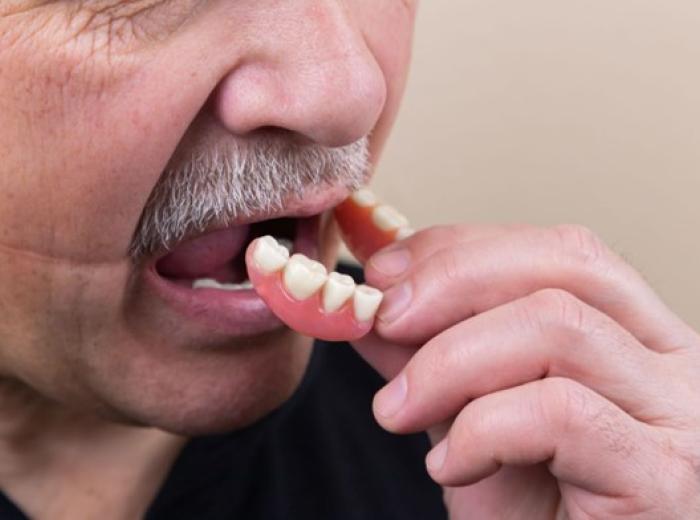 3 Clear Reasons You’ll Love Invisalign